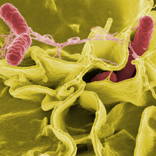 Color-enhanced scanning electron micrograph showing Salmonella Typhimurium (red) invading cultured human cells (Chaparral Pharmacy)